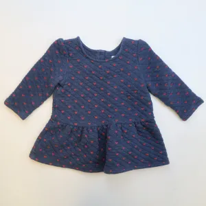 Gap - Tunic/Dress (12-18M)